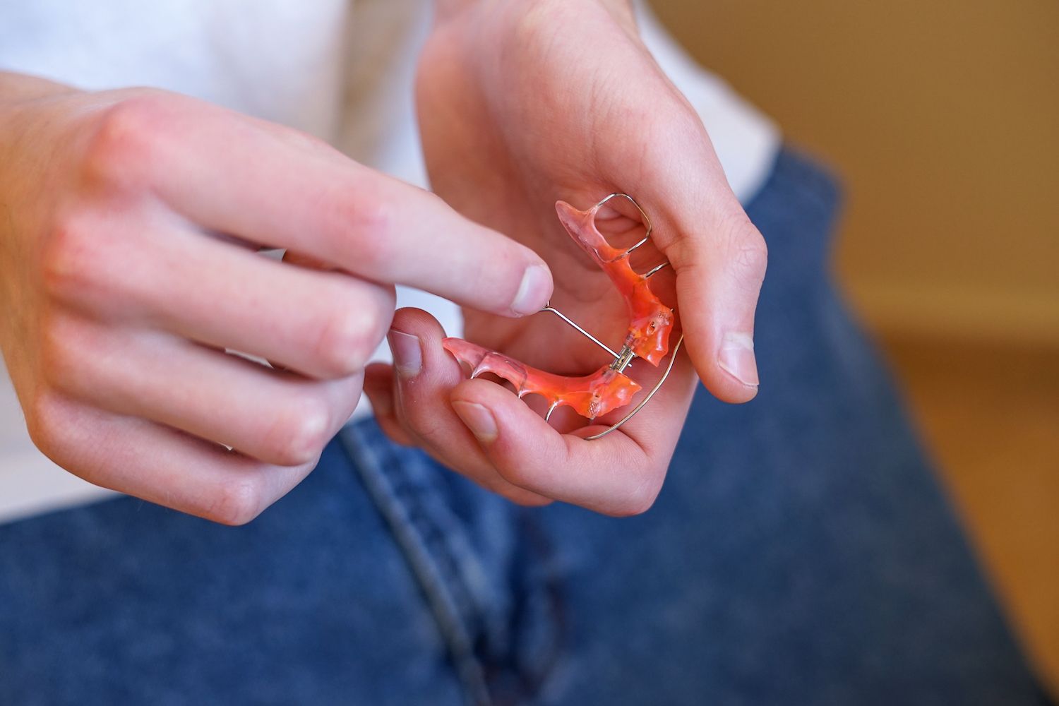 Palatal Expanders at Loeb Orthodontics